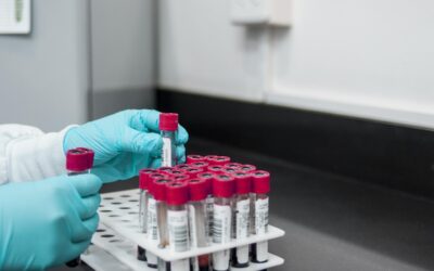 New Hope for Patients with Hereditary Hemorrhagic Telangiectasia