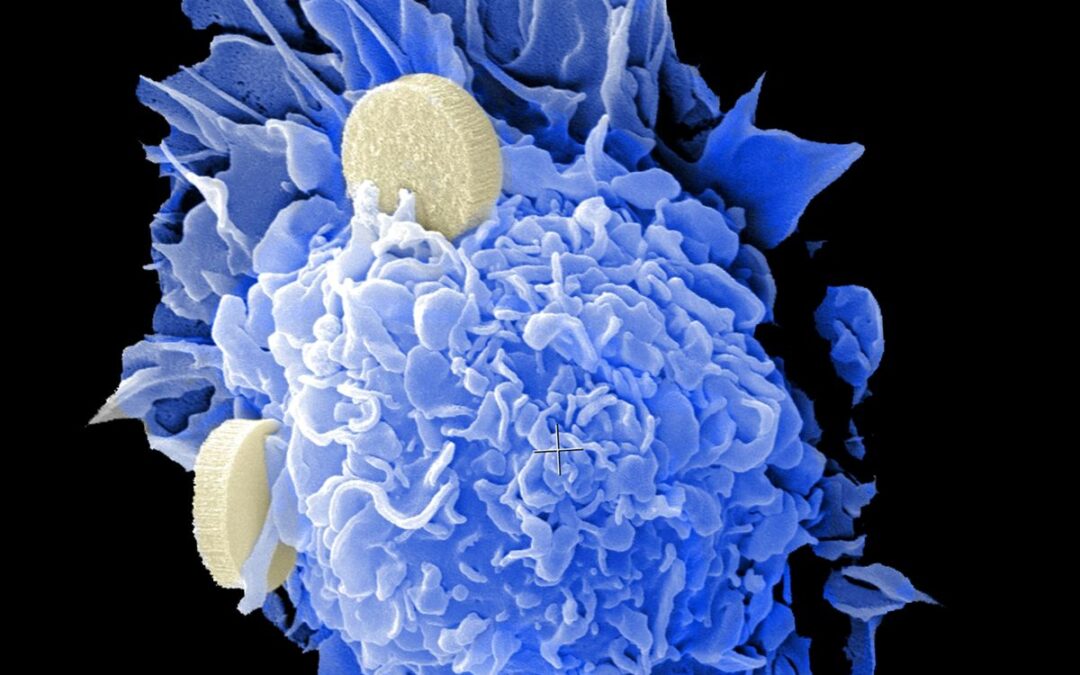 J&J Acquires Halda Therapeutics to Boost Oncology Pipeline