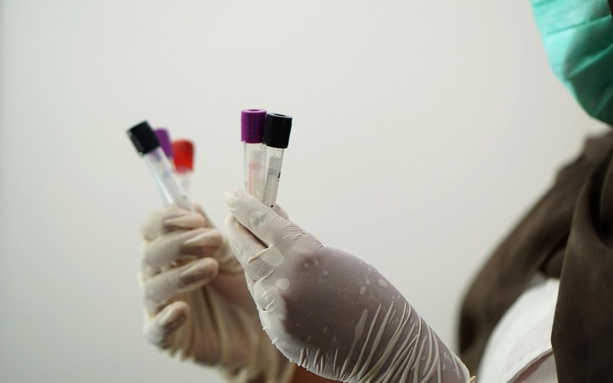 A medical laboratory team analysing blood samples and biomarkers using test tubes and diagnostic equipment.