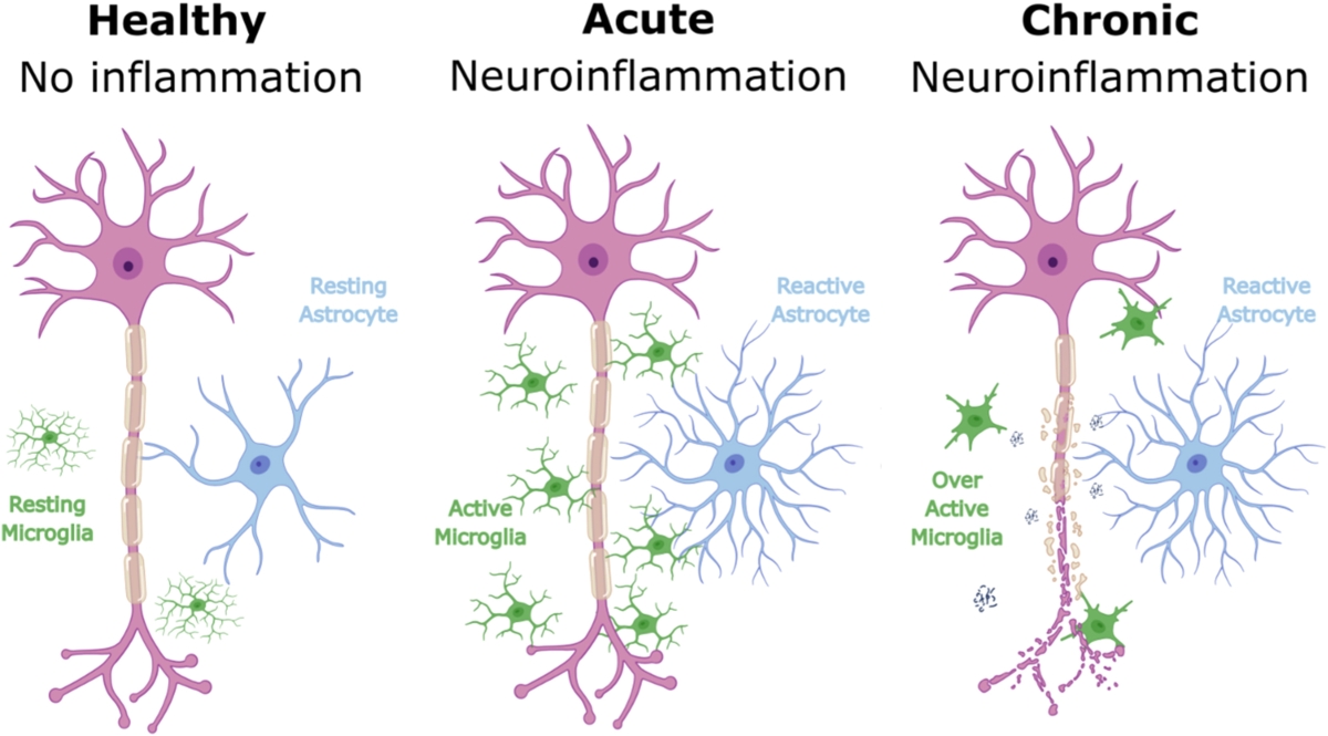 Figure 1. Cellular changes in response to varying degrees of inflammation. The figure illustrates the progression of neuroinflammation from a healthy state to acute and chronic inflammation.