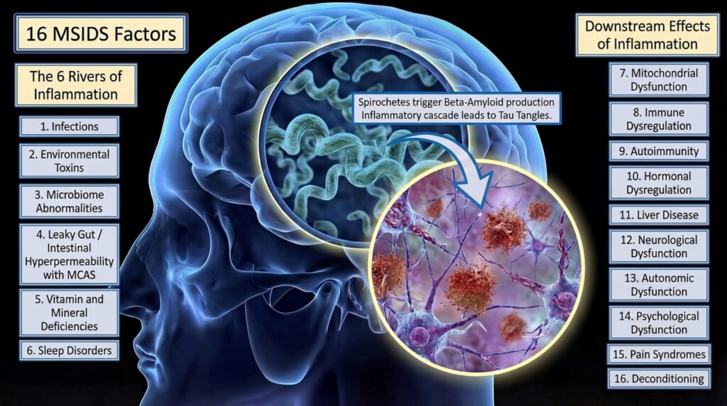 First Alzheimer’s Biomarker Reversal Linked to Lyme Disease Treatment
