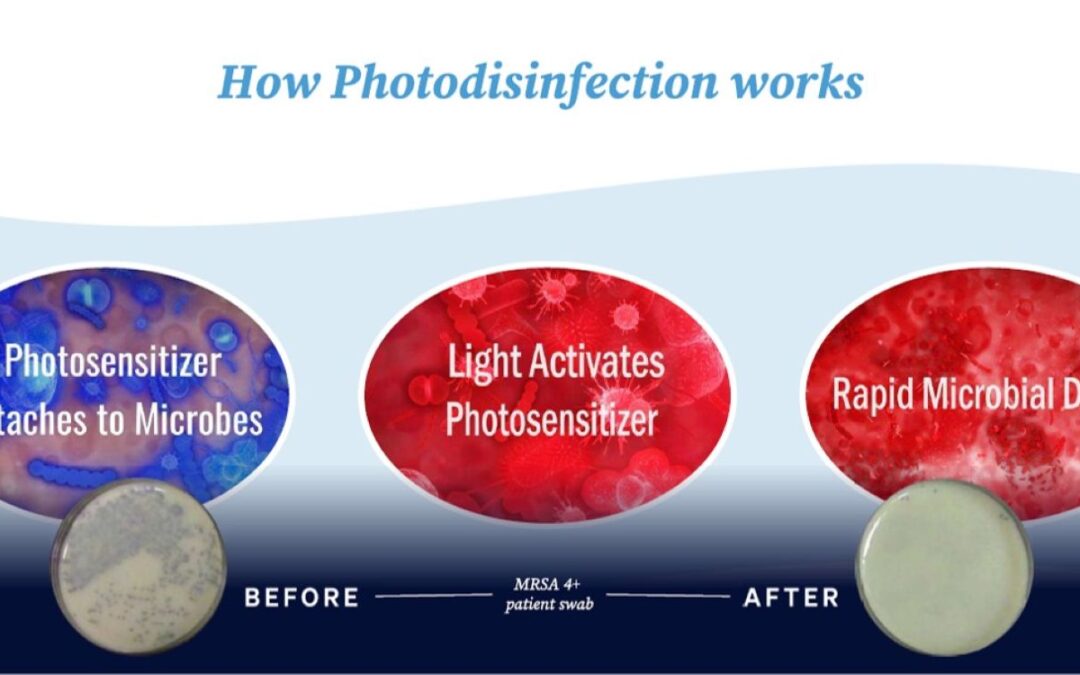 Is Photodisinfection the New Alternative to Traditional Antibiotics?