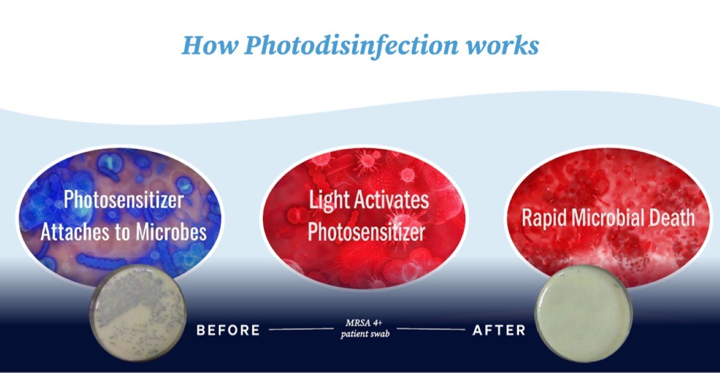 Photodisinfection antimicrobial resistance: three-stage diagram showing light-activated pathogen destruction
