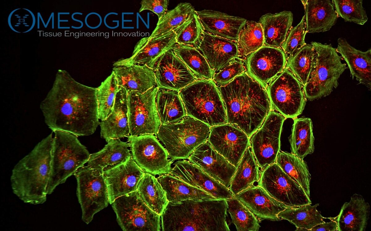 Fluorescence micrograph of cells with green cytoskeleton and blue nuclei, from Mesogen's autologous stem cells research