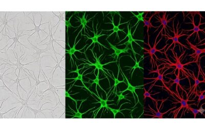 Exploring the Role of Astrocytes in MND With Translatable Human Cell Models