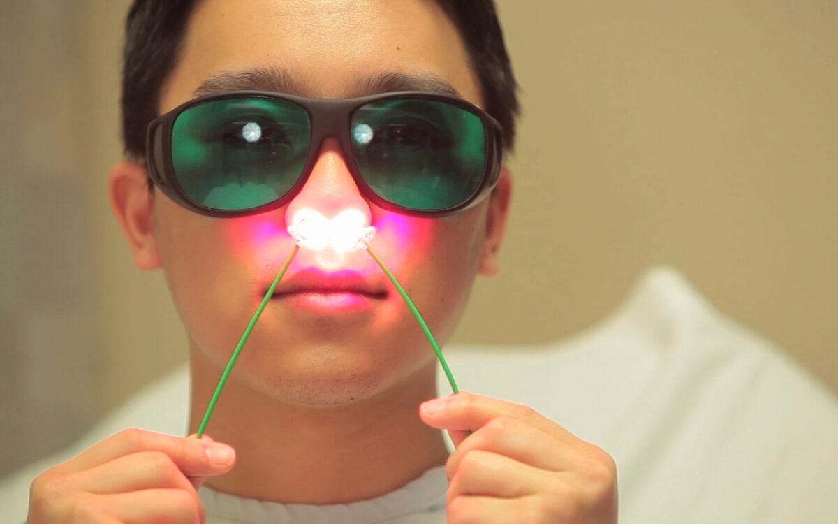 Patient in protective goggles receives Steriwave nasal photodisinfection via red-light applicators in both nostrils.